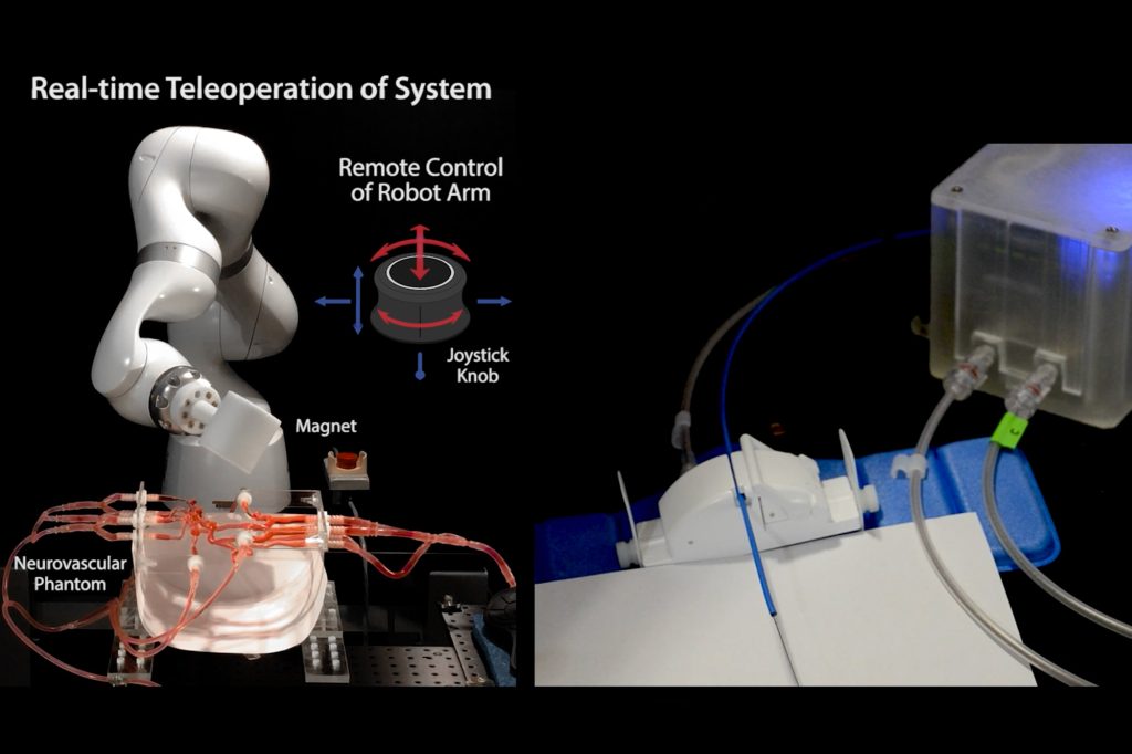 Bridging the Distance: How Remote Robotics is Revolutionizing Stroke Treatment Access