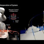 Bridging the Distance: How Remote Robotics is Revolutionizing Stroke Treatment Access